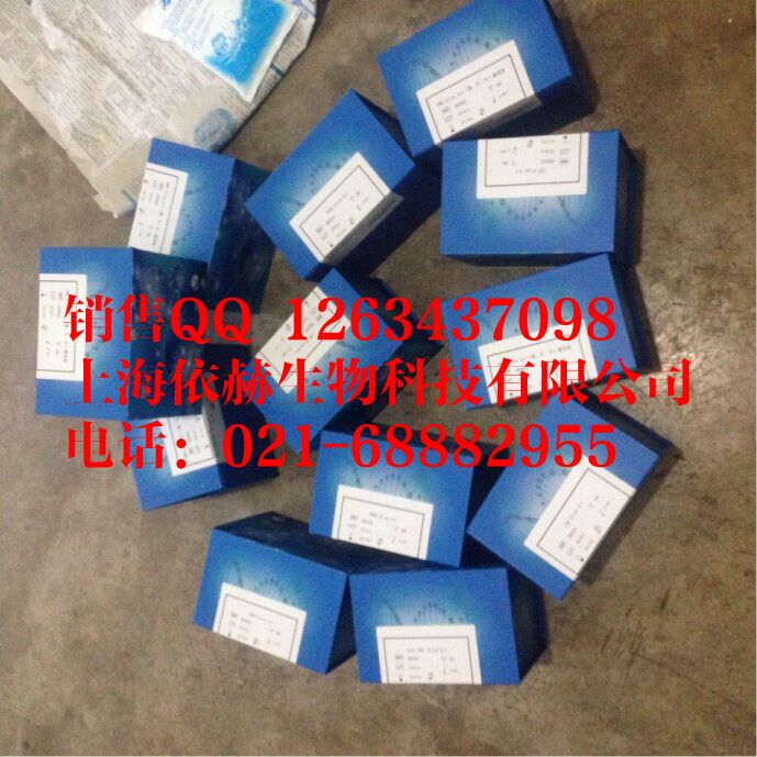 人抗软骨抗体(anti-cartilage-Ab)ELISA Kit